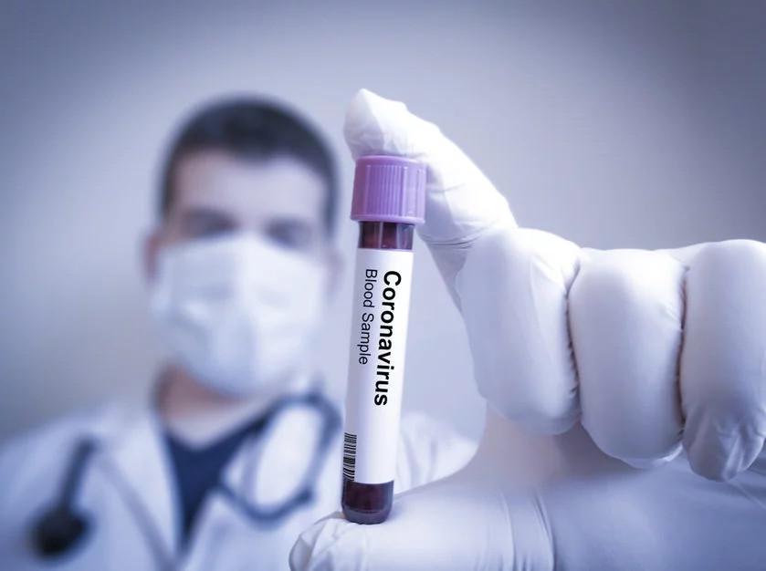 Samorzd diagnostw ostrzega m.in. przed patnymi pseudo testami na koronawirusa